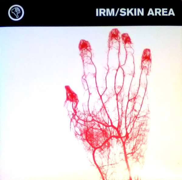 IRM / Skin Area - IRM / Skin Area | Segerhuva (SEGER 5)