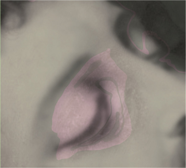 La Baracande - La Baracande | La Nòvia (NÒV 013)