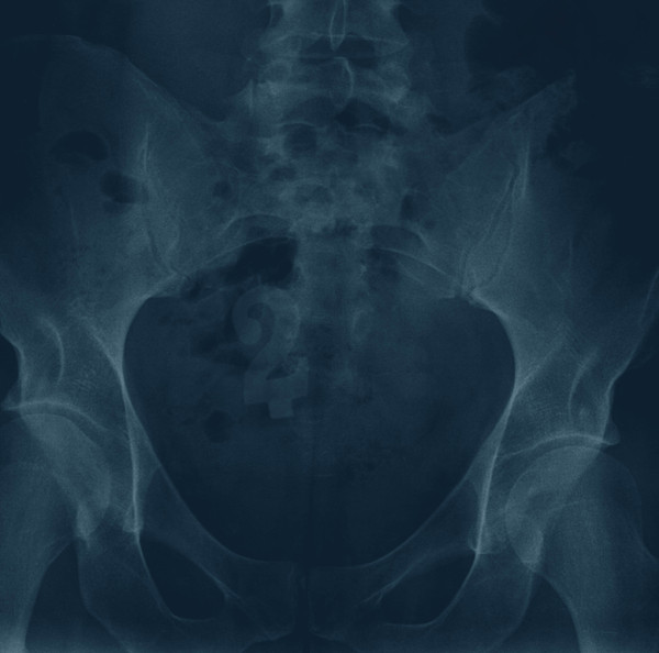 Various - Antipodean Anomalies 2 | Left Ear Records (LER 1031) - main