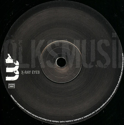 Volksmusik - X-Ray Eyes | Black Jack (BLACKJACK ES 10 R) - 2