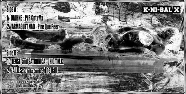 Various - Are You Hungry ? | K.Ni.Bal Record (K-NI-BAL X)